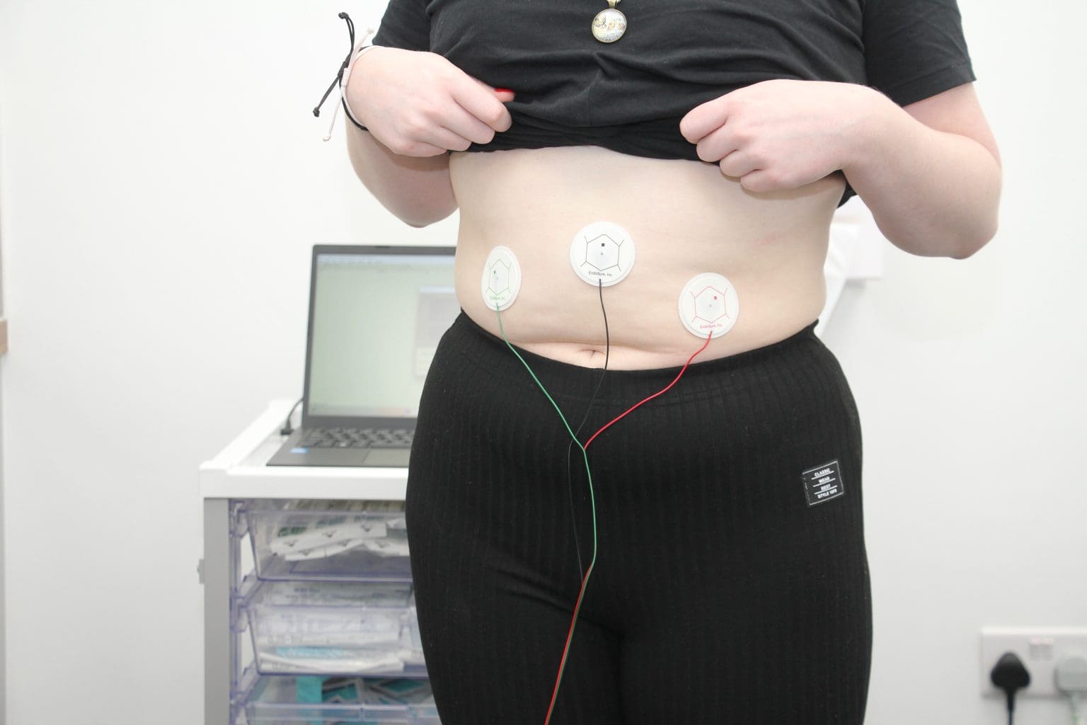 EndoSure Testing Specialists - Non Surgical Endometriosis Test